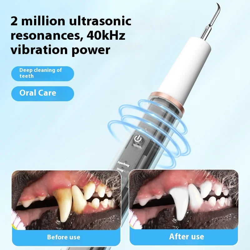 PearlClean Ultrasonic Scaler